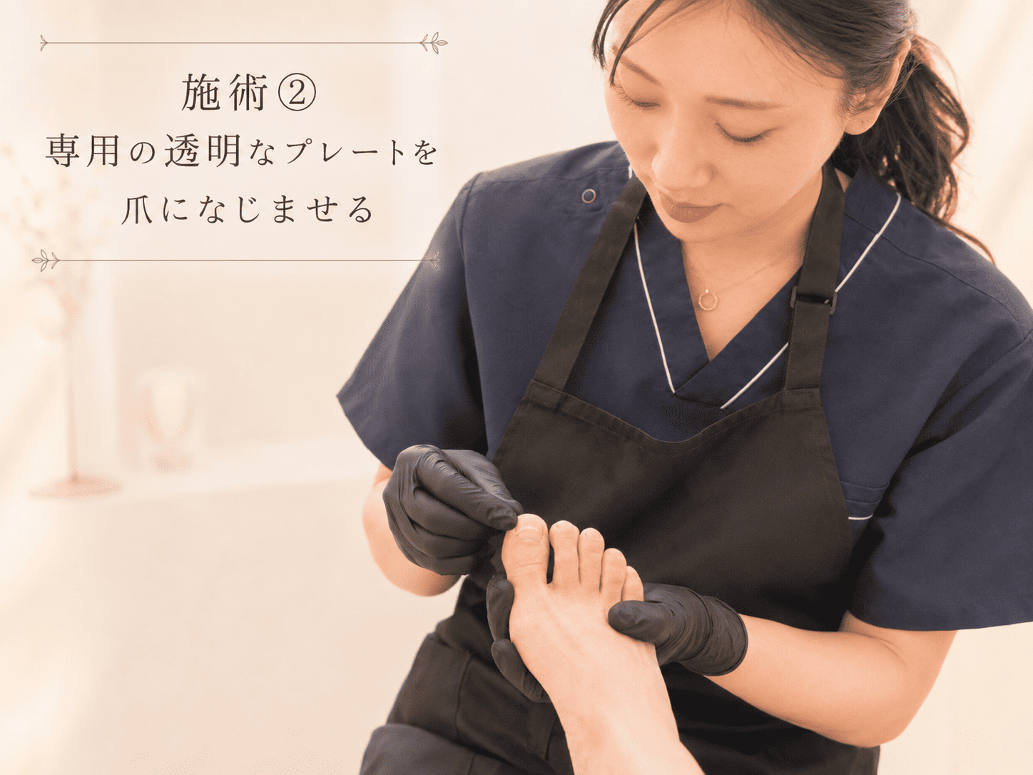 プレート装着