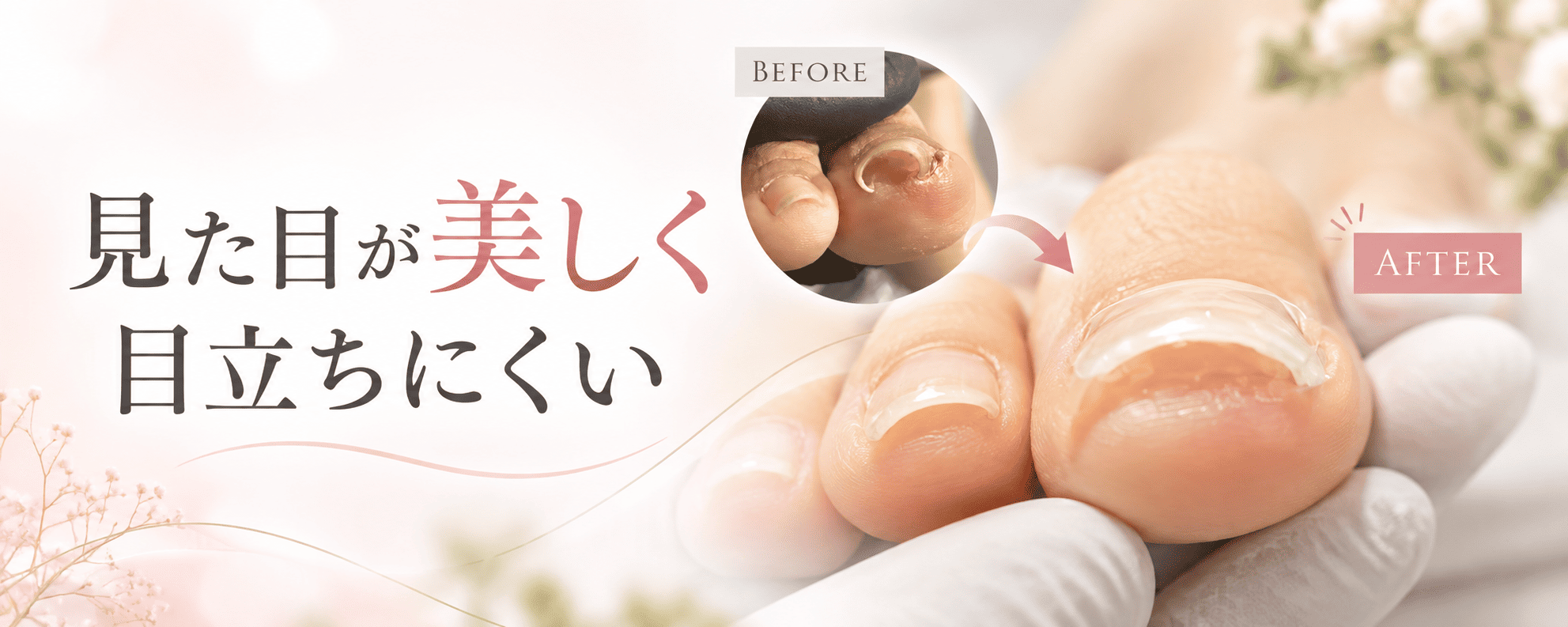 見た目が美しく目立ちにくい