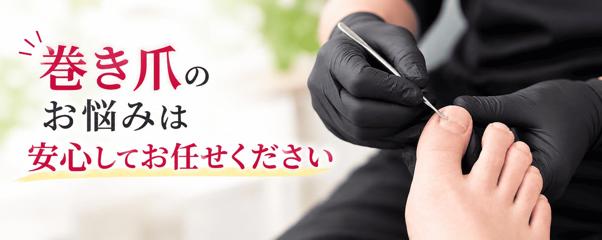 巻き爪のお悩みは安心してお任せください